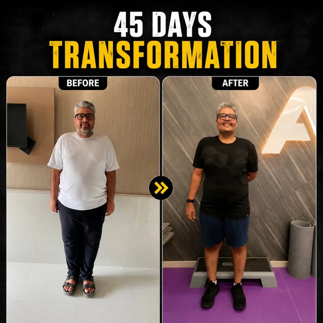 Client before and after a 45-day transformation, visibly slimmer through the face, chest and waist